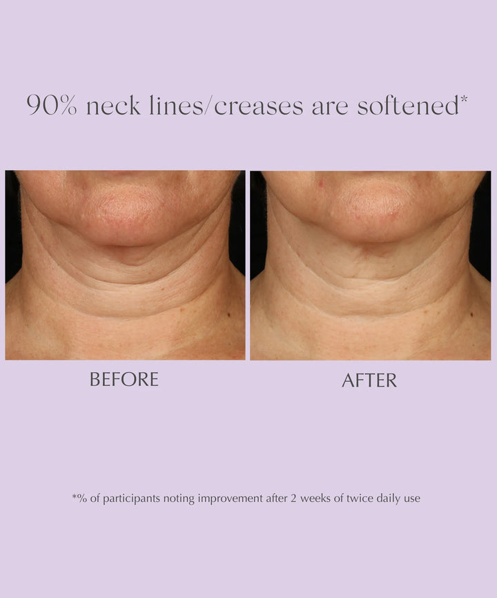 Exuviance AGE REVERSE+ Toning Neck Cream