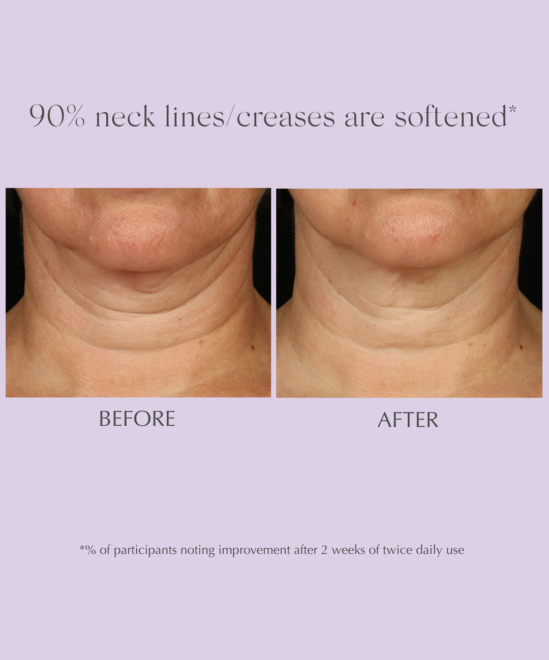 Exuviance Triple Action neck crème